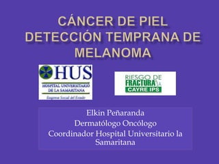 Cáncer de PielDetección temprana de Melanoma<br />Elkin Peñaranda<br />Dermatólogo Oncólogo<br />Coordinador Hospital Univ...