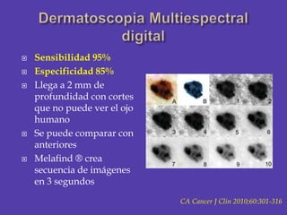 DermatoscopiaMultiespectral digital<br />Sensibilidad 95%<br />Especificidad 85%<br />Llega a 2 mm de profundidad con cort...