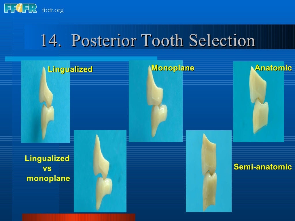 22.criteria for posterior tooth selection