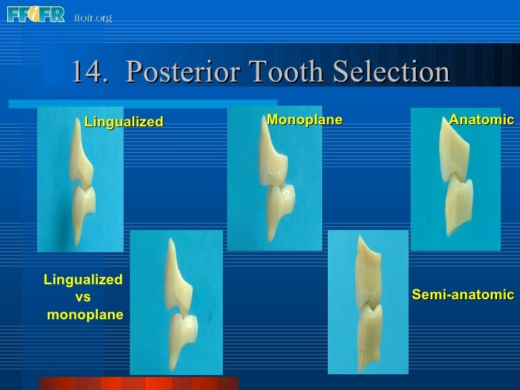 22.criteria for posterior tooth selection