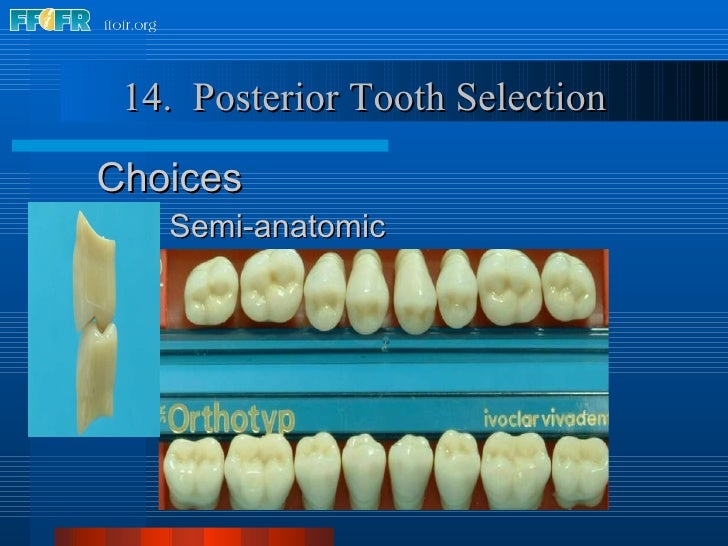22.criteria for posterior tooth selection