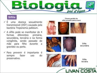  É uma doença sexualmente
transmissível (DST) causada pela
bactéria Treponema pallidum.
 A sífilis pode se manifestar de 4
formas diferentes: primária,
secundária, terciária e na forma
congênita, sendo passada de
mãe para filho durante a
gravidez ou parto.
 Para prevenir é importante é
sempre fazer uso do
preservativo.
Sífilis
 