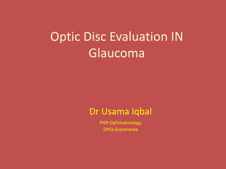 Optic Disc Evaluation IN
Glaucoma
Dr Usama Iqbal
PGR-Ophthalmology
DHQ-Gujranwala
 