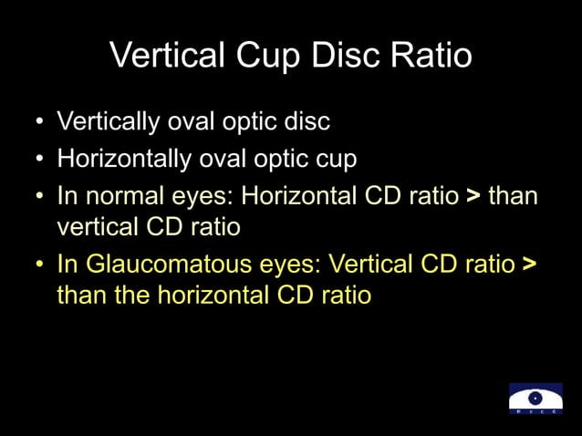 22-Optic-Disc-Evaluation-IN-Glaucoma.ppt