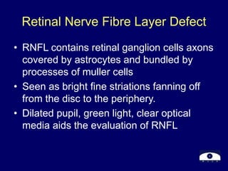 Retinal Nerve Fibre Layer Defect
• RNFL contains retinal ganglion cells axons
covered by astrocytes and bundled by
processes of muller cells
• Seen as bright fine striations fanning off
from the disc to the periphery.
• Dilated pupil, green light, clear optical
media aids the evaluation of RNFL
 