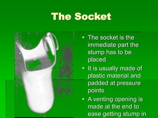 Orthotics & Prosthetics in Rehabilitation | PPT