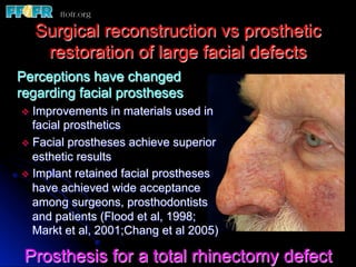 Restoration of Facial Defects - Basic Priniciples | PDF