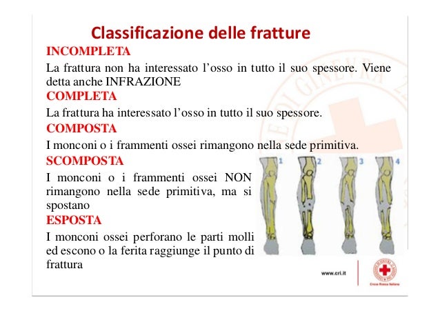 Come liberarsi da rimedi di gente di parassiti a bambini