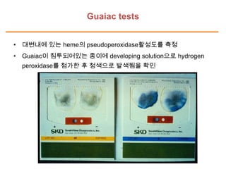 Guaiac tests
• 대변내에 있는 heme의 pseudoperoxidase활성도를 측정
• Guaiac이 침투되어있는 종이에 developing solution으로 hydrogen
peroxidase를 첨가한 후 청색으로 발색됨을 확인

 
