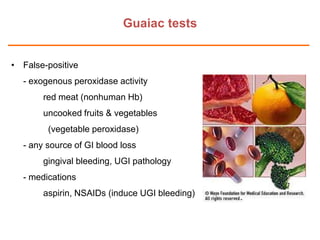 Guaiac tests
• False-positive
- exogenous peroxidase activity
red meat (nonhuman Hb)
uncooked fruits & vegetables
(vegetable peroxidase)
- any source of GI blood loss
gingival bleeding, UGI pathology
- medications

aspirin, NSAIDs (induce UGI bleeding)

 