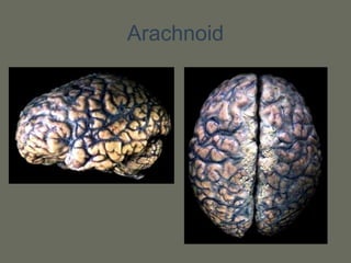 Arachnoid
 