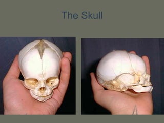 The Skull
 