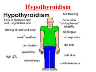 Hypothyroidism
 
