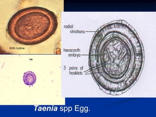 Taenia spp Egg.
With stain
With Iodine
 