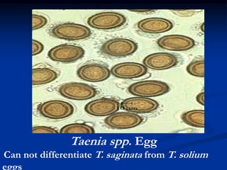 Taenia spp. Egg
Can not differentiate T. saginata from T. solium
eggs
 