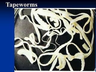 Tapeworms
 