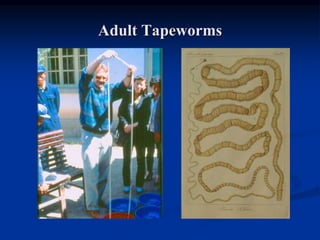 Adult Tapeworms
 