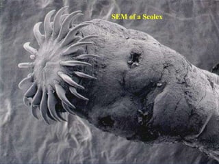 SEM of a Scolex
 