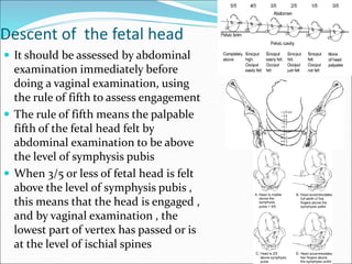Descent of the fetal head
 It should be assessed by abdominal
examination immediately before
doing a vaginal examination, using
the rule of fifth to assess engagement
 The rule of fifth means the palpable
fifth of the fetal head felt by
abdominal examination to be above
the level of symphysis pubis
 When 3/5 or less of fetal head is felt
above the level of symphysis pubis ,
this means that the head is engaged ,
and by vaginal examination , the
lowest part of vertex has passed or is
at the level of ischial spines
 