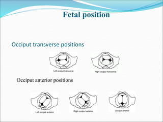 Occiput transverse positions
Occiput anterior positions
Fetal position
 
