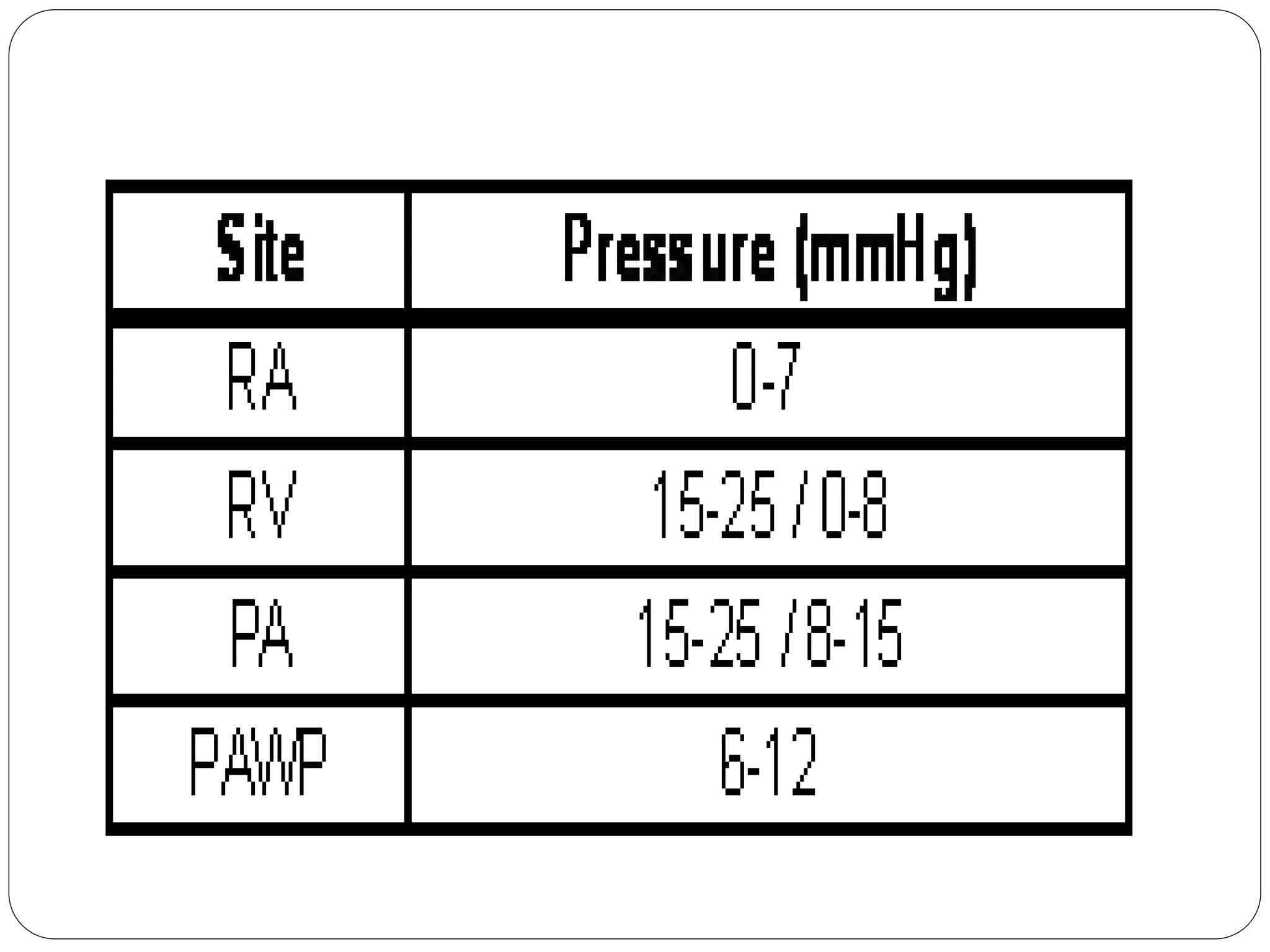 electrocardiogram power point, basic ecg interp | PPT
