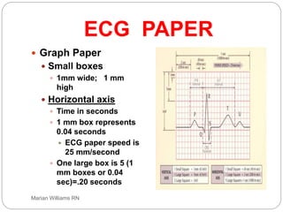 electrocardiogram power point, basic ecg interp | PPT