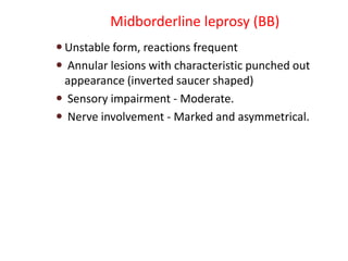 Midborderline leprosy (BB)
 Unstable form, reactions frequent
 Annular lesions with characteristic punched out
appearance (inverted saucer shaped)
 Sensory impairment - Moderate.
 Nerve involvement - Marked and asymmetrical.
 