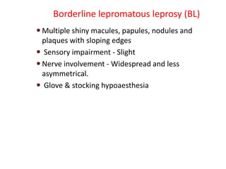 Borderline lepromatous leprosy (BL)
 Multiple shiny macules, papules, nodules and
plaques with sloping edges
 Sensory impairment - Slight
 Nerve involvement - Widespread and less
asymmetrical.
 Glove & stocking hypoaesthesia
 