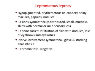 Lepromatous leprosy
 Hypopigmented, erythematous or coppery, shiny
macules, papules, nodules
 Lesions symmetrically distributed, small, multiple,
shiny with normal or mild sensory loss
 Leonine facies: Infiltration of skin with nodules, loss
of eyebrows and eyelashes
 Nerve involvement symmetrical; glove & stocking
anaesthesia
 Lepromin test - Negative
 