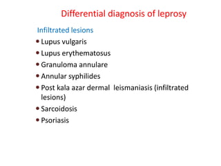 Differential diagnosis of leprosy
Infiltrated lesions
 Lupus vulgaris
 Lupus erythematosus
 Granuloma annulare
 Annular syphilides
 Post kala azar dermal leismaniasis (infiltrated
lesions)
 Sarcoidosis
 Psoriasis
 