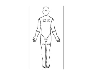 Comprehensive Overview of Burn Injuries: Assessment, Classification ...