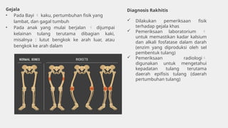 Kaki Rakhitis All about Vitamin D (Calciferol) for human | PPTX