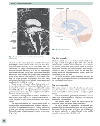 Applied Radiological Anatomy 2nd Edition Paul Butler Adam Mitchell | PDF