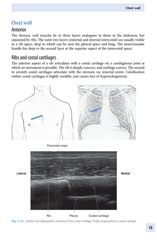 Atlas Of Musculoskeletal Ultrasound Anatomy 2nd Edition Mike Bradley | PDF
