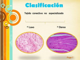 Page 7
Tejido conectivo no especializado
Laxo Denso
 