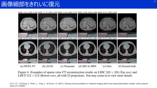 画像細部をきれいに復元
14
図式引用：[7] Song, Y., Shen, L., Xing, L., & Ermon, S. (2021). Solving inverse problems in medical imaging with score-based generative models. arXiv preprint
arXiv:2111.08005.
 