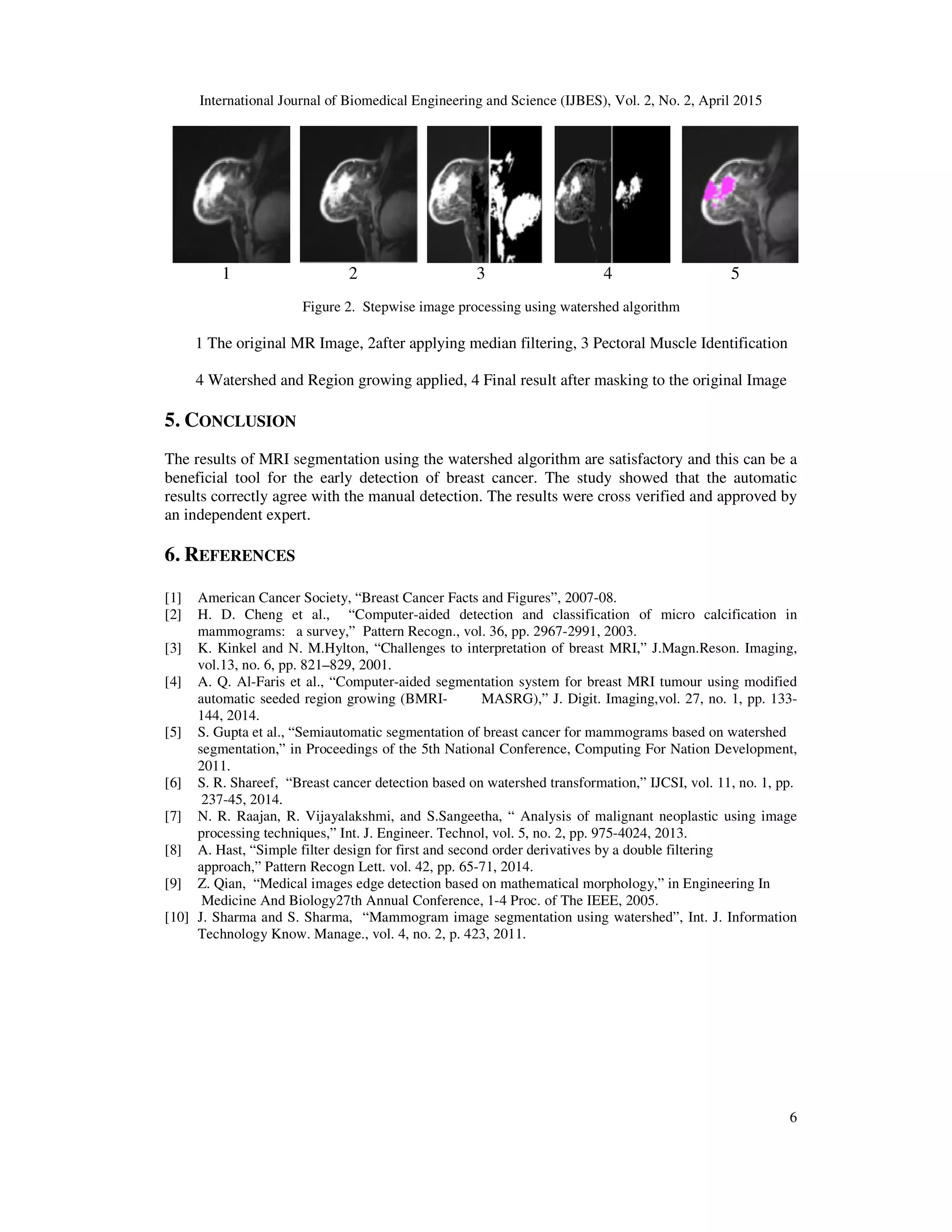 International Journal of Biomedical Engineering and Science (IJBES), Vol. 2, No. 2, April 2015
6
1 2 3 4 5
Figure 2. Stepwise image processing using watershed algorithm
1 The original MR Image, 2after applying median filtering, 3 Pectoral Muscle Identification
4 Watershed and Region growing applied, 4 Final result after masking to the original Image
5. CONCLUSION
The results of MRI segmentation using the watershed algorithm are satisfactory and this can be a
beneficial tool for the early detection of breast cancer. The study showed that the automatic
results correctly agree with the manual detection. The results were cross verified and approved by
an independent expert.
6. REFERENCES
[1] American Cancer Society, “Breast Cancer Facts and Figures”, 2007-08.
[2] H. D. Cheng et al., “Computer-aided detection and classification of micro calcification in
mammograms: a survey,” Pattern Recogn., vol. 36, pp. 2967-2991, 2003.
[3] K. Kinkel and N. M.Hylton, “Challenges to interpretation of breast MRI,” J.Magn.Reson. Imaging,
vol.13, no. 6, pp. 821–829, 2001.
[4] A. Q. Al-Faris et al., “Computer-aided segmentation system for breast MRI tumour using modified
automatic seeded region growing (BMRI- MASRG),” J. Digit. Imaging,vol. 27, no. 1, pp. 133-
144, 2014.
[5] S. Gupta et al., “Semiautomatic segmentation of breast cancer for mammograms based on watershed
segmentation,” in Proceedings of the 5th National Conference, Computing For Nation Development,
2011.
[6] S. R. Shareef, “Breast cancer detection based on watershed transformation,” IJCSI, vol. 11, no. 1, pp.
237-45, 2014.
[7] N. R. Raajan, R. Vijayalakshmi, and S.Sangeetha, “ Analysis of malignant neoplastic using image
processing techniques,” Int. J. Engineer. Technol, vol. 5, no. 2, pp. 975-4024, 2013.
[8] A. Hast, “Simple filter design for first and second order derivatives by a double filtering
approach,” Pattern Recogn Lett. vol. 42, pp. 65-71, 2014.
[9] Z. Qian, “Medical images edge detection based on mathematical morphology,” in Engineering In
Medicine And Biology27th Annual Conference, 1-4 Proc. of The IEEE, 2005.
[10] J. Sharma and S. Sharma, “Mammogram image segmentation using watershed”, Int. J. Information
Technology Know. Manage., vol. 4, no. 2, p. 423, 2011.
 
