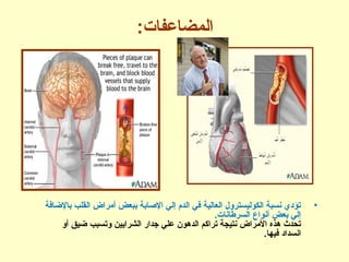 :‫المضاعفات‬
•‫بالاضافة‬ ‫القلب‬ ‫أمراض‬ ‫ببعض‬ ‫الاصابة‬ ‫إلي‬ ‫الدم‬ ‫في‬ ‫العالية‬ ‫الكوليسترول‬ ‫نسبة‬ ‫تؤدي‬
.‫السرطانات‬ ‫أنواع‬ ‫بعض‬ ‫إلي‬
‫أو‬ ‫اضيق‬ ‫وتسبب‬ ‫الشراجيين‬ ‫جدار‬ ‫علي‬ ‫الدهون‬ ‫تراكم‬ ‫نتيجة‬ ‫المراض‬ ‫هذه‬ ‫تحدث‬
.‫فيها‬ ‫انسداد‬
 
