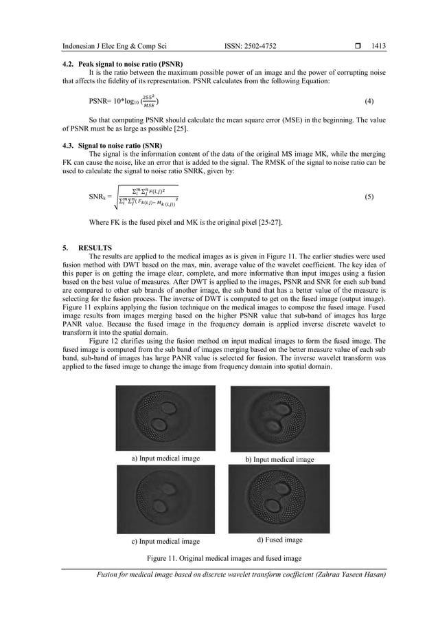 Fusion For Medical Image Based On Discrete Wavelet Transform Fusion For Medical Image Based On Discrete Wavelet Transform
