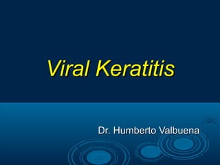 Viral KeratitisViral Keratitis
Dr. Humberto ValbuenaDr. Humberto Valbuena
 