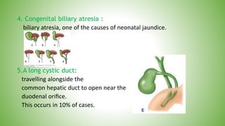 4. Congenital biliary atresia :
biliary atresia, one of the causes of neonatal jaundice.
5.A long cystic duct:
travelling alongside the
common hepatic duct to open near the
duodenal oriﬁce.
This occurs in 10% of cases.
 