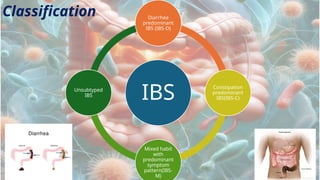 Comprehensive Overview of Irritable Bowel Syndrome: Pathophysiology ...