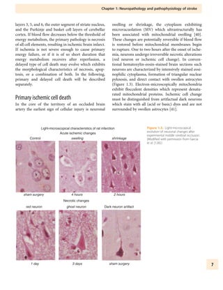 Textbook Of Stroke Medicine Michael Brainin Wolfdieter Heiss | PDF
