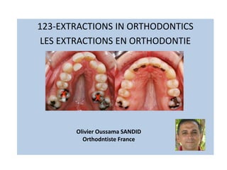 123-EXTRACTIONS IN ORTHODONTICS
LES EXTRACTIONS EN ORTHODONTIE
Olivier Oussama SANDID
Orthodntiste France
 