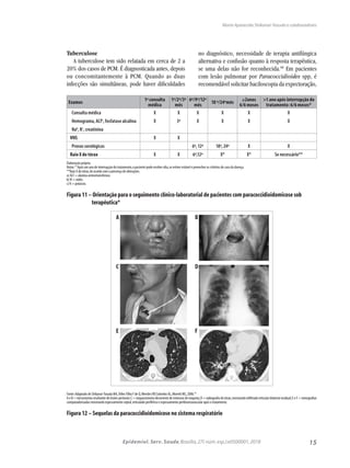 15Epidemiol. Serv. Saude,Brasília,27( núm.esp.):e0500001,2018
Tuberculose
A tuberculose tem sido relatada em cerca de 2 a
20% dos casos de PCM. É diagnosticada antes, depois
ou concomitantemente à PCM. Quando as duas
infecções são simultâneas, pode haver dificuldades
no diagnóstico, necessidade de terapia antifúngica
alternativa e confusão quanto à resposta terapêutica,
se uma delas não for reconhecida.68
Em pacientes
com lesão pulmonar por Paracoccidioides spp, é
recomendável solicitar baciloscopia da expectoração,
Fonte:Adaptado de Shikanai-Yasuda MA,Telles Filho F de Q,Mendes RP,Colombo AL,Moretti ML,2006.39
A e B = microstomia resultante de lesões periorais;C = traqueostomia decorrente de estenose de traqueia;D = radiografia do tórax,mostrando infiltrado reticular bilateral residual;E e F = tomografias
computadorizadas mostrando espessamento septal,reticulado periférico e espessamento peribroncovascular após o tratamento.
Figura 12 – Sequelas da paracoccidioidomicose no sistema respiratório
A
C
E
B
D
F
Exames
1ª consulta
médica
1º/2º/3º
mês
6º/9º/12º
mês
18 º/24ºmês
≥2anos
6/6 meses
>1 ano após interrupção do
tratamento: 6/6 meses*
Consulta médica X X X X X X
Hemograma, ALTa
, fosfatase alcalina X 3º X X X X
Nab
, Kc
, creatinina
VHS X X
Provas sorológicas 6º, 12º 18º, 24º X X
Raio X do tórax X X 6º,12º X* X* Se necessário**
Elaboração própria.
Notas:* Após um ano de interrupção do tratamento,o paciente pode receber alta,se estiver estável e preencher os critérios de cura da doença.
**Raio X do tórax,de acordo com a presença de alterações.
a) ALT = alanina aminotransferase.
b) N = sódio.
c) K = potássio.
Figura 11 – Orientação para o seguimento clínico-laboratorial de pacientes com paracoccidioidomicose sob
terapêutica*
Maria Aparecida Shikanai-Yasuda e colaboradores
 
