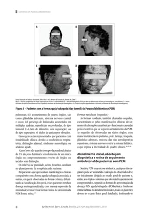8 Epidemiol. Serv. Saude,Brasília,27( núm.esp.):e0500001,2018
Consenso em Paracoccidiodomicose
pulmonar; iii) acometimento de outros órgãos, tais
como glândulas adrenais, sistema nervoso central
e ossos; iv) presença de linfonodos acometidos em
múltiplas cadeias, superficiais ou profundas, do tipo
tumoral (>2,0cm de diâmetro, sem supuração) ou
do tipo supurativo; v) títulos de anticorpos elevados.
Casos graves são representados por pacientes com
instabilidade clínica, devido a insuficiência respira-
tória, disfunção adrenal, síndrome neurológica ou
abdome agudo.
Casos leves são aqueles com perda ponderal abaixo
de 5% do peso habitual e envolvimento de um único
órgão ou comprometimento restrito de órgãos ou
tecidos sem disfunção.
Os critérios de gravidade, acima descritos, auxiliam
no planejamento da terapêutica do paciente.
Hápacientesqueapresentammanifestaçõesclínicas
compatíveis com a forma aguda/subaguda associada a
outras, em geral observadas na forma crônica, dificul-
tandoaclassificação.Emgeral,essespacientesrevelam
doença muito generalizada, com intensa supressão da
imunidade celular. Essa forma clínica foi denominada
PCM forma mista.43
Formas residuais (sequelas)
As formas residuais, também chamadas sequelas,
caracterizam-se pelas manifestações clínicas decor-
rentes de alterações anatômicas e funcionais causadas
pelas cicatrizes que se seguem ao tratamento da PCM.
As sequelas são observadas em vários órgãos, com
maior incidência em pulmões, pele, laringe, traqueia,
glândulas adrenais, mucosa das vias aerodigestivas
superiores, sistema nervoso central e sistema linfático,
o que explica a diversidade do quadro clínico.44,45,46
Atendimento inicial,abordagem
diagnóstica e rotina de seguimento
ambulatorial de pacientes com PCM
SendoaPCMumamicosesistêmica,qualquersítioor-
gânicopodeseracometido.Aatençãodoobservadordeve
ser inicialmente dirigida ao estado geral do paciente e,
então,aosórgãosesistemasquesãomaisfrequentemente
comprometidos, segundo as formas de apresentação da
doença: PCM aguda/subaguda e PCM crônica. Conforme
rotinahabitualdeatendimentomédico,todosospacientes
devem ter exame físico geral detalhado, lembrando-se
A B
C D
Fonte:Adaptado de Shikanai-Yasuda MA,Telles Filho F de Q,Mendes RP,Colombo AL,Moretti ML,2006.39
Obs:A = massas ganglionares em região supraclavicular,cervical e submandibular;B = linfoadenomegalia da PCM,que deve ser diferenciada de doenças hematológicas,como linfoma;C = lesões
ulceradas de aspecto verruciforme em face e pavilhão,resultante de disseminação hematogênica;D = lesões de aspecto papulonodular e ulceradas,resultantes de disseminação hematogênica.
Figura 5 – Pacientes com a forma aguda/subaguda (tipo juvenil) da Paracoccidioidomicose(PCM)
 
