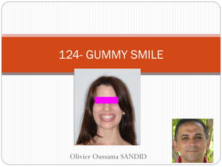Olivier Oussama SANDID
124- GUMMY SMILE
 
