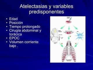 Atelectasias y variables predisponentes Edad Posición  Tiempo prolongado Cirugía abdominal y torácica EPOC Volumen corriente bajo . 