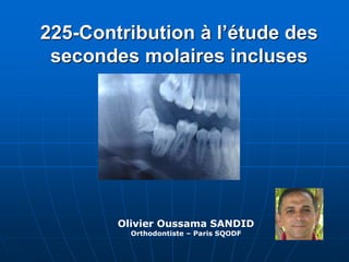 225-Contribution à l’étude des
secondes molaires incluses
Olivier Oussama SANDID
Orthodontiste – Paris SQODF
 