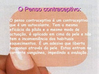 O Penso contraceptivo:O Penso contraceptivo:
• O penso contraceptivo é um contraceptivo
que é um autocolante. Tem a mesma
eficácia da pílula e o mesmo modo de
actuação, é aplicado em cima da pele e não
tem a inconveniência dos habituais
esquecimentos. É um adesivo que liberta
hormonas através da pele. Estas entram na
corrente sanguínea, impedindo a ovulação.
 